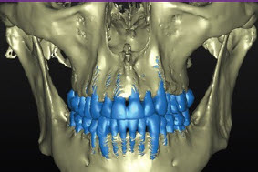 Initial dentoalveolar deficiencies